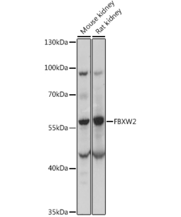 FBXW2 Rabbit Polyclonal Antibody