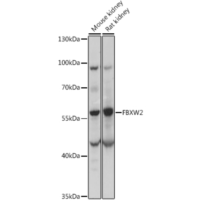 FBXW2 Rabbit Polyclonal Antibody