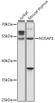 NUSAP1 Rabbit Polyclonal Antibody