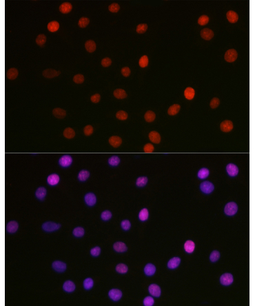 Acetyl-HMGB1-K29 Rabbit Polyclonal Antibody
