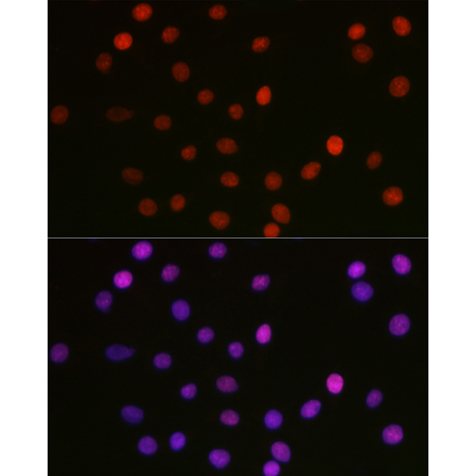 Acetyl-HMGB1-K29 Rabbit Polyclonal Antibody