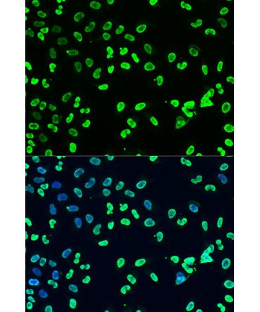 DiMethyl-DNMT3A-K44 Rabbit Polyclonal Antibody