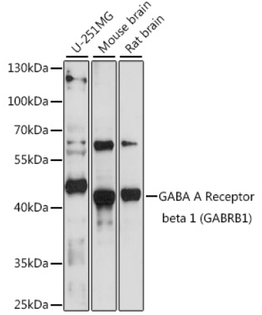 GABA A Receptor beta 1 (GABRB1) Rabbit Polyclonal Antibody