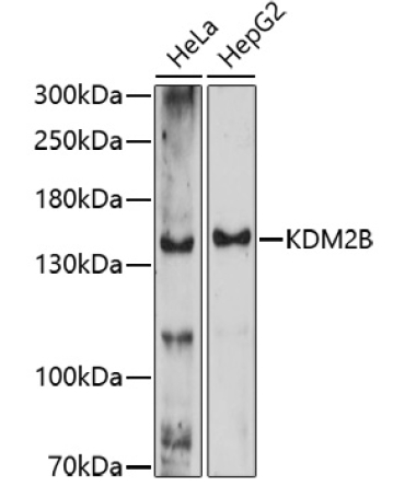 KDM2B Rabbit Polyclonal Antibody