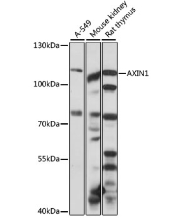 AXIN1 Rabbit Polyclonal Antibody