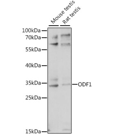 ODF1 Rabbit Polyclonal Antibody