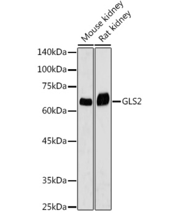 GLS2 Rabbit Polyclonal Antibody