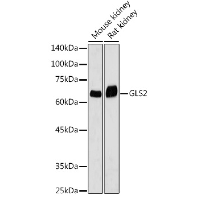 GLS2 Rabbit Polyclonal Antibody