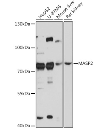 MASP2 Rabbit Polyclonal Antibody