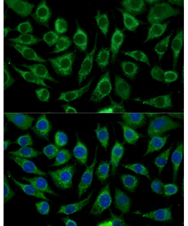 ABCD2 Rabbit Polyclonal Antibody