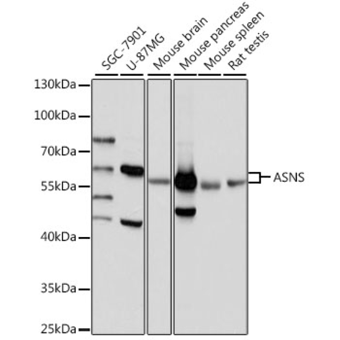 ASNS Rabbit Polyclonal Antibody