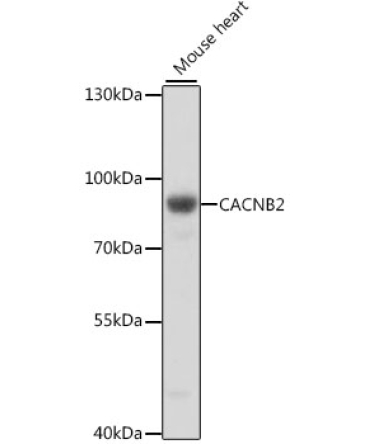 CACNB2 Rabbit Polyclonal Antibody