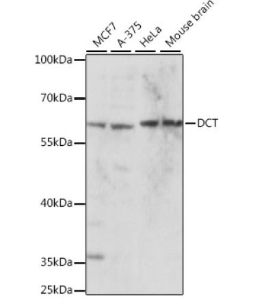DCT Rabbit Polyclonal Antibody