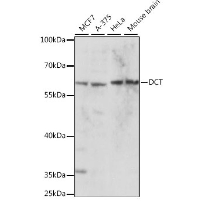 DCT Rabbit Polyclonal Antibody