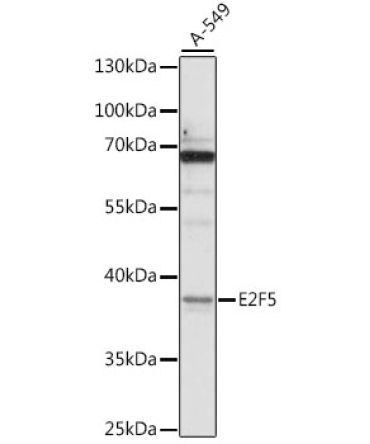 E2F5 Rabbit Polyclonal Antibody