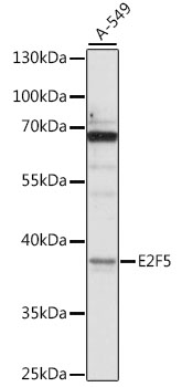 E2F5 Rabbit Polyclonal Antibody