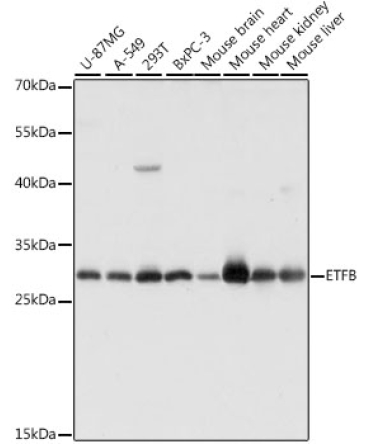 ETFB Rabbit Polyclonal Antibody