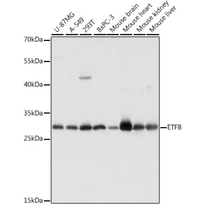 ETFB Rabbit Polyclonal Antibody