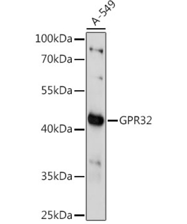 GPR32 Rabbit Polyclonal Antibody