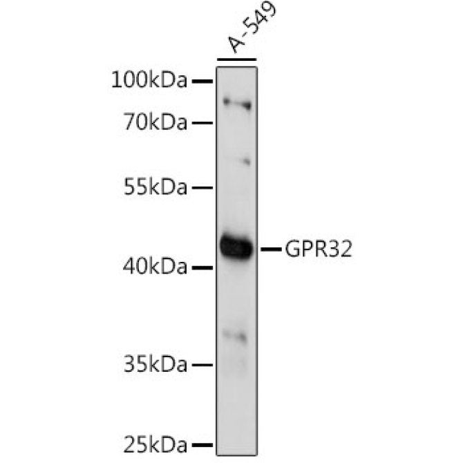 GPR32 Rabbit Polyclonal Antibody