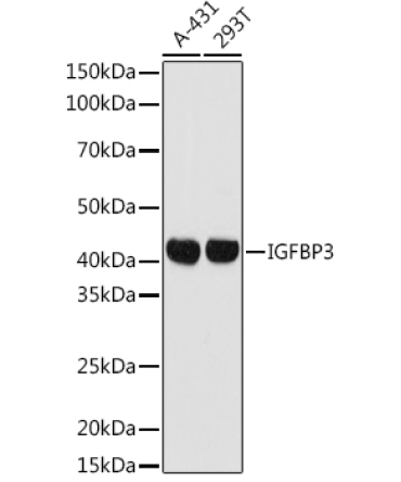 IGFBP3 Rabbit Polyclonal Antibody