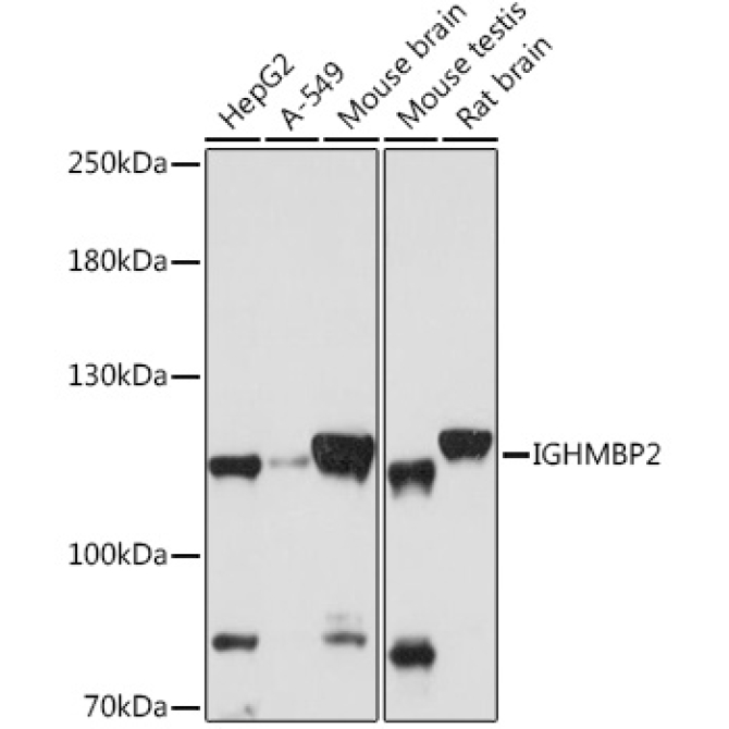 IGHMBP2 Rabbit Polyclonal Antibody