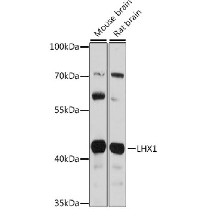 LHX1 Rabbit Polyclonal Antibody