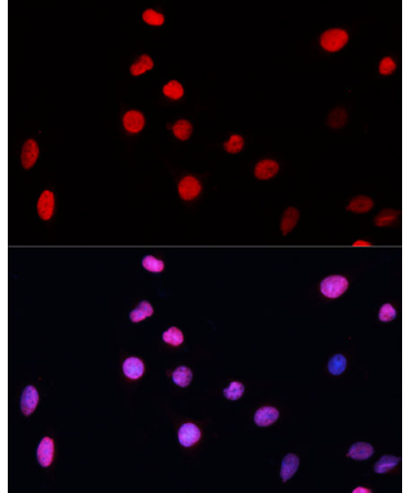 ERCC5 Rabbit Polyclonal Antibody