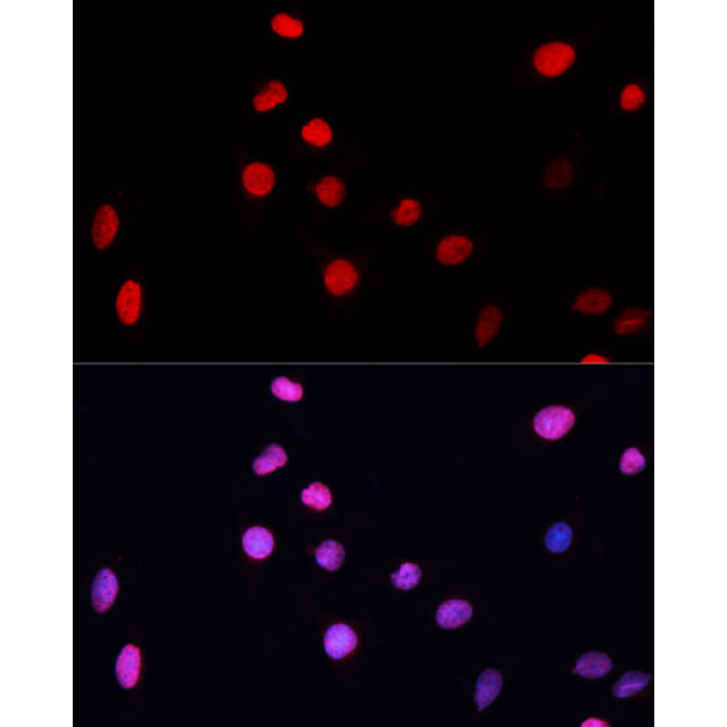 ERCC5 Rabbit Polyclonal Antibody