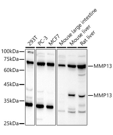 MMP13 Rabbit Polyclonal Antibody