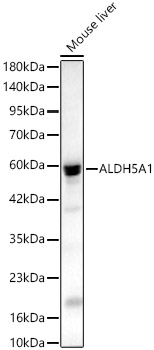 ALDH5A1 Rabbit Polyclonal Antibody