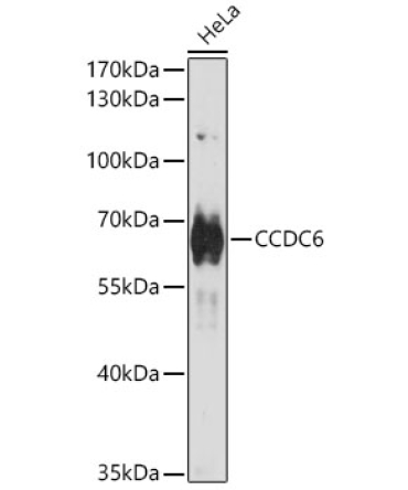 CCDC6 Rabbit Polyclonal Antibody