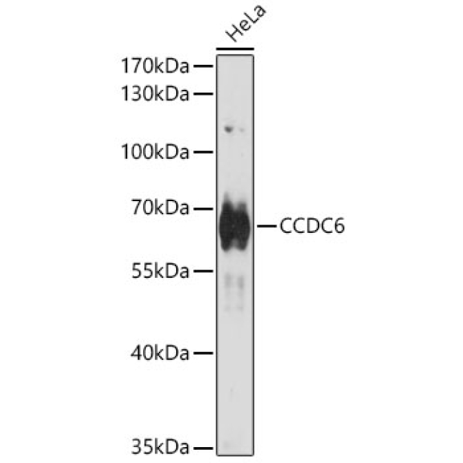 CCDC6 Rabbit Polyclonal Antibody