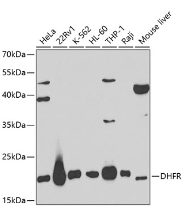 DHFR Rabbit Polyclonal Antibody