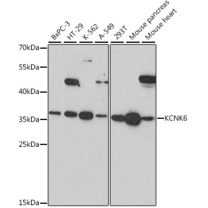KCNK6 Rabbit Polyclonal Antibody