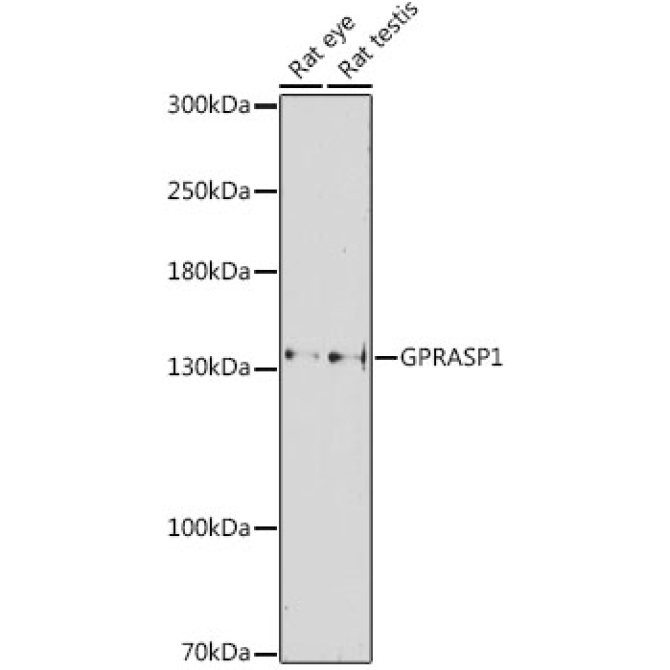 GPRASP1 Rabbit Polyclonal Antibody
