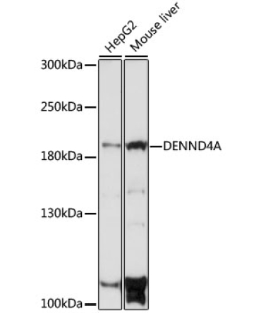 DENND4A Rabbit Polyclonal Antibody