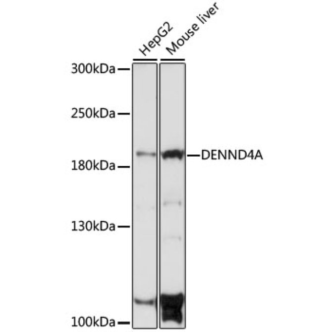 DENND4A Rabbit Polyclonal Antibody