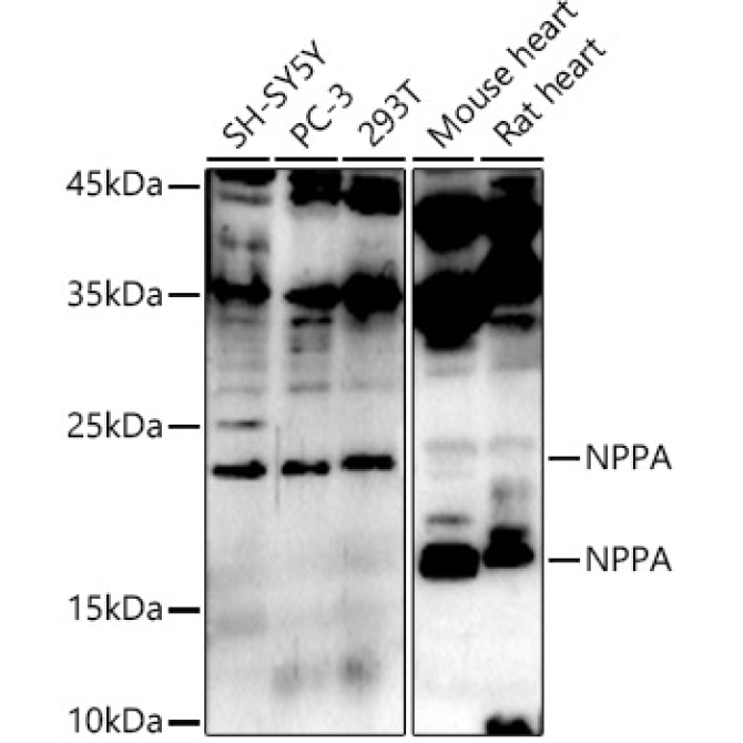 NPPA Rabbit Polyclonal Antibody