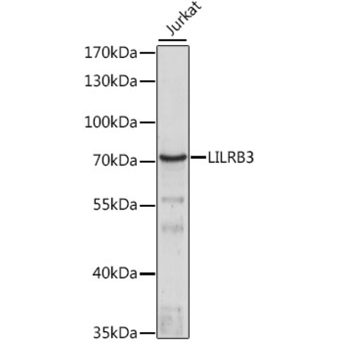 LILRB3 Rabbit Polyclonal Antibody