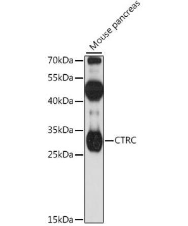 CTRC Rabbit Polyclonal Antibody