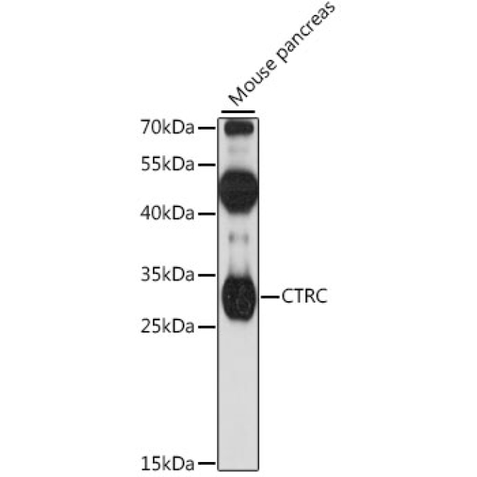 CTRC Rabbit Polyclonal Antibody