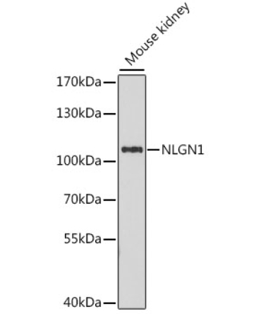 NLGN1 Rabbit Polyclonal Antibody
