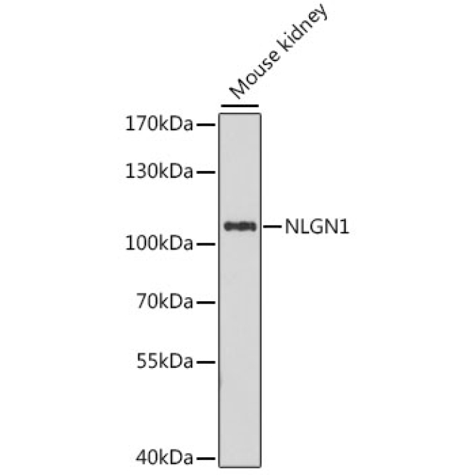NLGN1 Rabbit Polyclonal Antibody