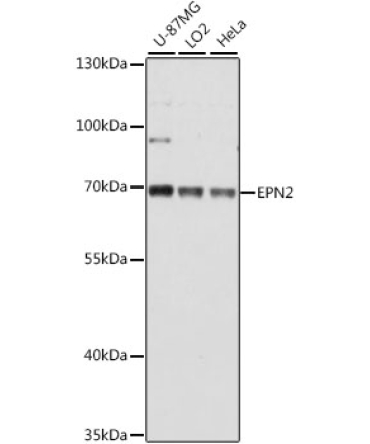 EPN2 Rabbit Polyclonal Antibody