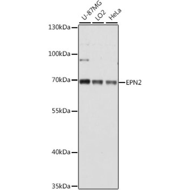 EPN2 Rabbit Polyclonal Antibody