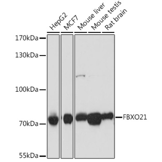 FBXO21 Rabbit Polyclonal Antibody