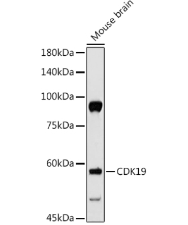 CDK19 Rabbit Polyclonal Antibody