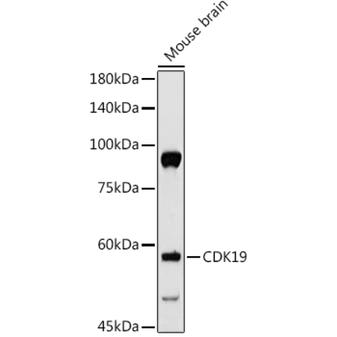CDK19 Rabbit Polyclonal Antibody