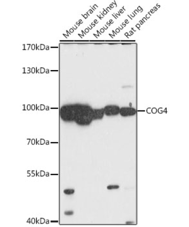 COG4 Rabbit Polyclonal Antibody
